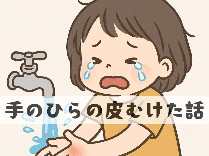 手のひらの皮がむけた子どもが手を洗っている様子の絵　泣いている