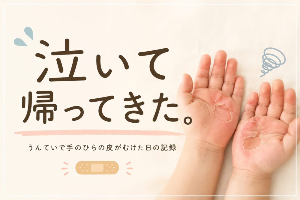 「泣いて帰ってきた。」という文字と、手のひらの皮がむけた子どもの両手のイメージ。うんていで手のひらの皮がむけた日の記録を紹介するアイキャッチ画像。
